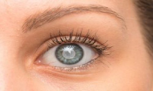 Cataracts