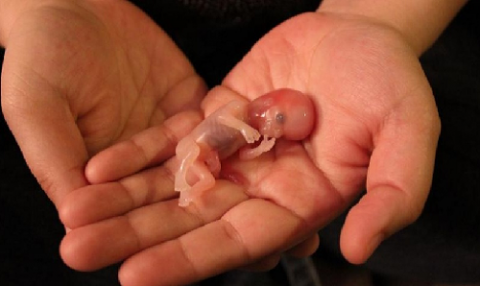 Miscarriage