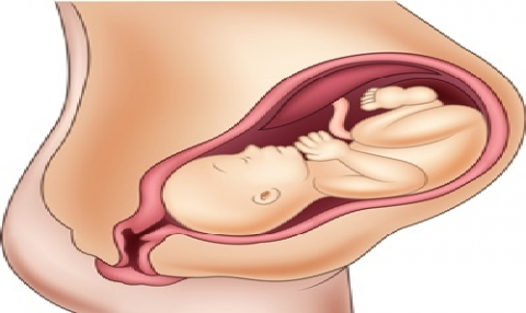 Womb